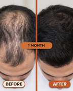 OUHOE - Biotin Hair Growth Serum (100% Result)