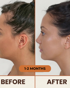 OUHOE - Biotin Hair Growth Serum (100% Result)