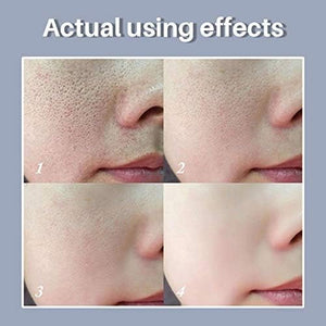 LANBENA - Pore Solution Serum
